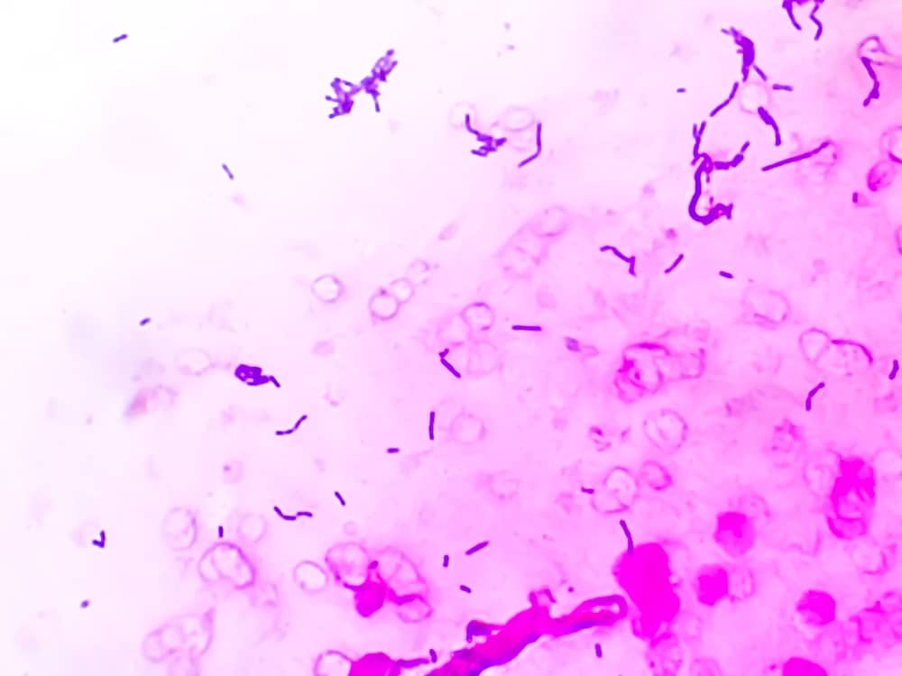 nhuộm gram vi khuẩn là gì