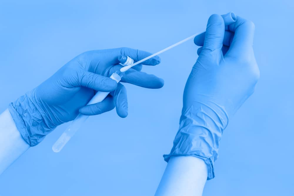 kết hợp với các xét nghiệm khác để giúp chính xác test pcr