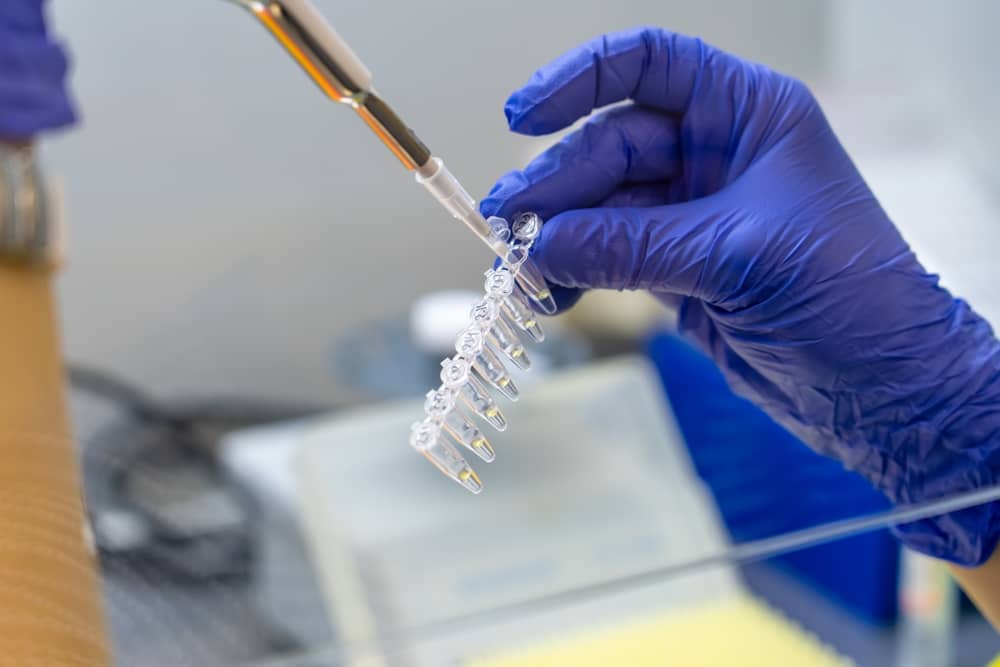 phương pháp pcr hiệu quả xét nghiệm