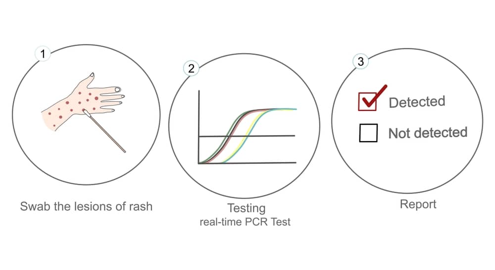 quy trình xét nghiệm pcr