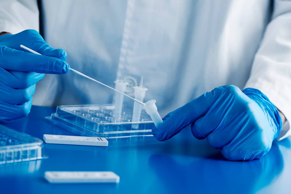 thu thập bệnh phẩm xét nghiệm pcr