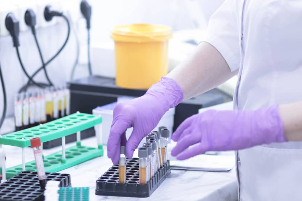 vai trò kết quả xét nghiệm PCR
