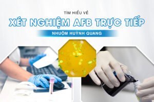 afb trực tiếp nhuộm huỳnh quang