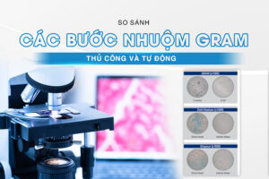 các bước nhuộm gram