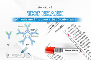test nhanh sốt xuất huyết