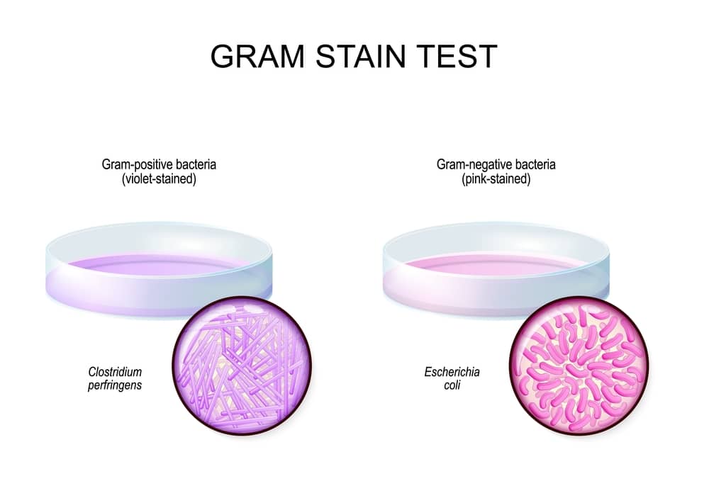 cơ chế trong phản ứng hóa học nhuộm gram âm màu gì