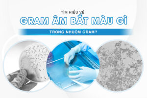 gram âm bắt màu gì
