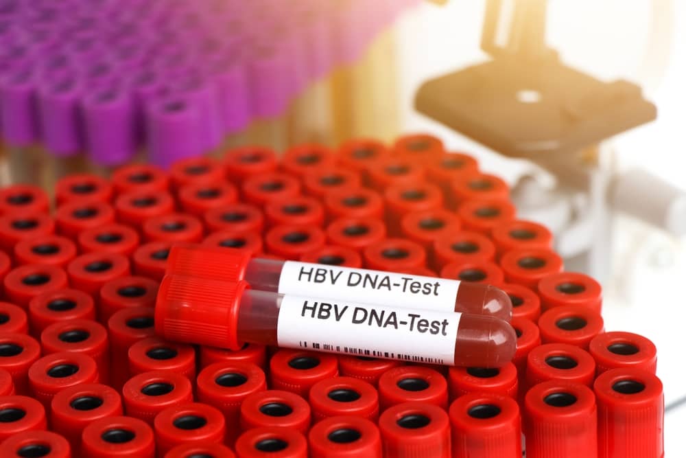 hbv dna định lượng là gì