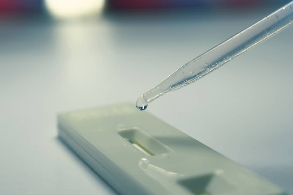 lưu ý khi xét nghiệm sốt xuất huyết