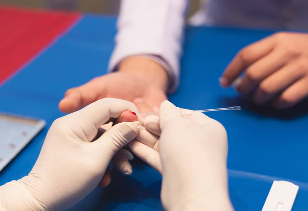 quy trình xét nghiệm sốt xuất huyết chuẩn xác