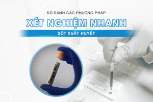 xét nghiệm nhanh sốt xuất huyết