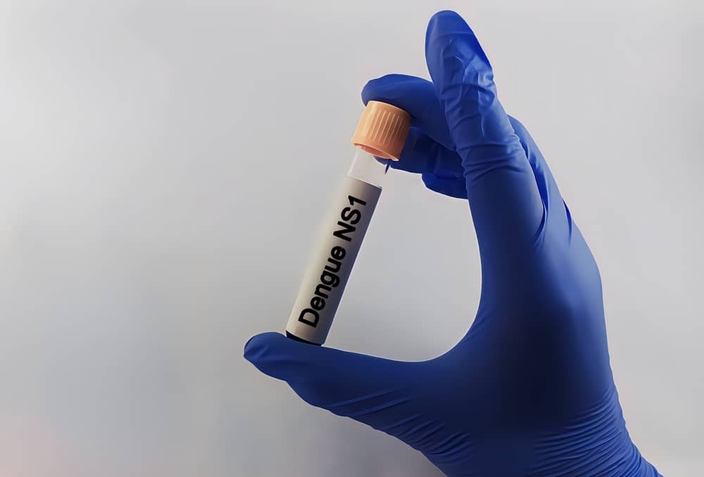 xét nghiệm nhanh sốt xuất huyết có cơ sở chuẩn xác