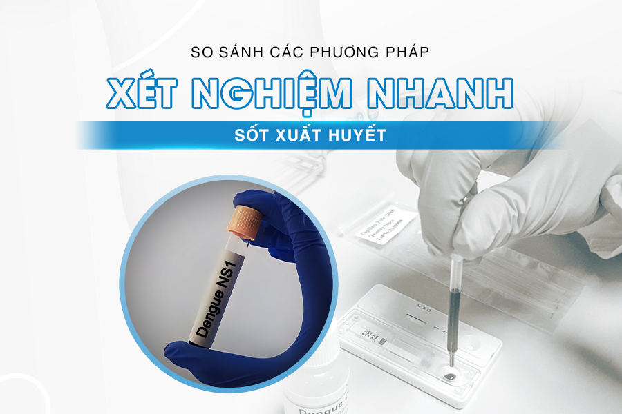 xét nghiệm nhanh sốt xuất huyết