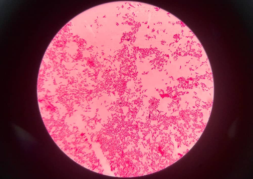 ý nghĩa của màu hồng đỏ trong nhuộm gram