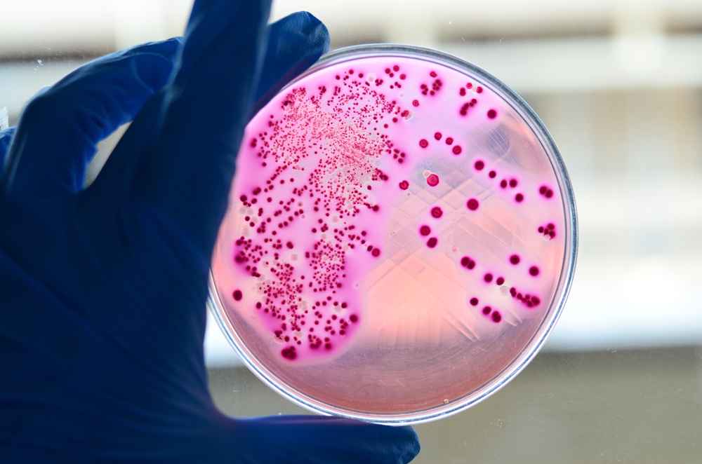 trực khuẩn gram âm trong bệnh lý