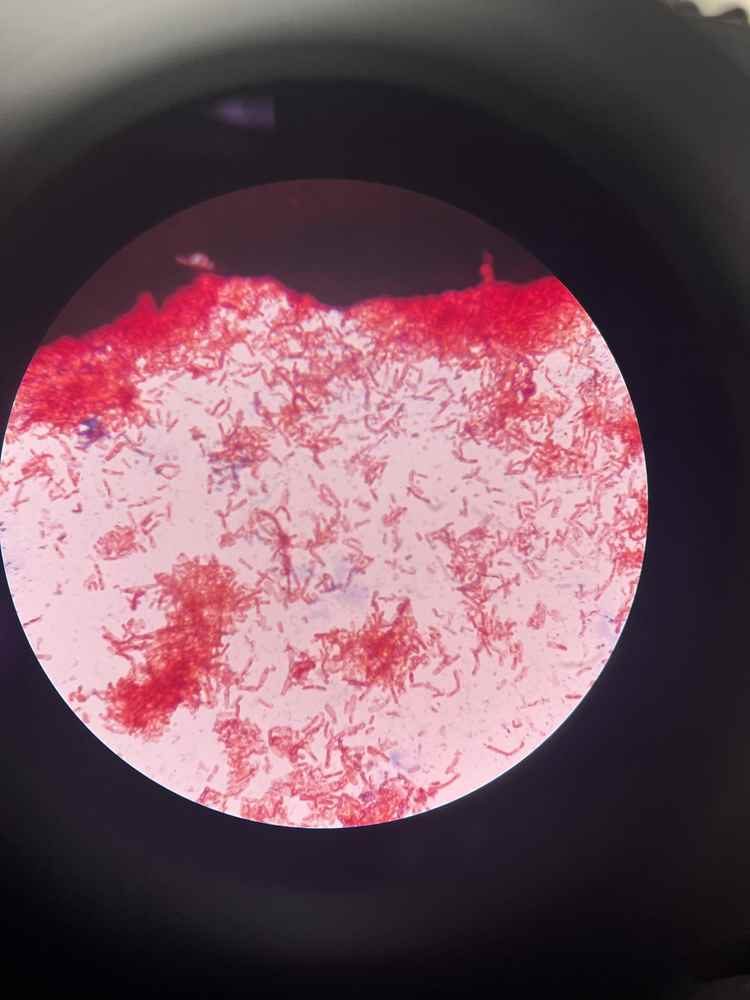 Các loại trực khuẩn gram âm