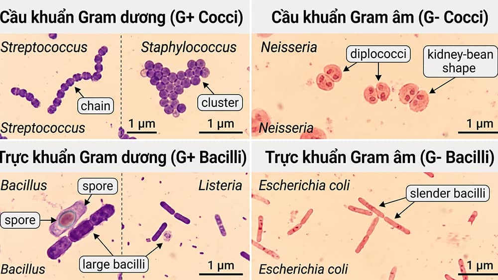 Chi tiết Hình thái và Tính Gram của Vi khuẩn