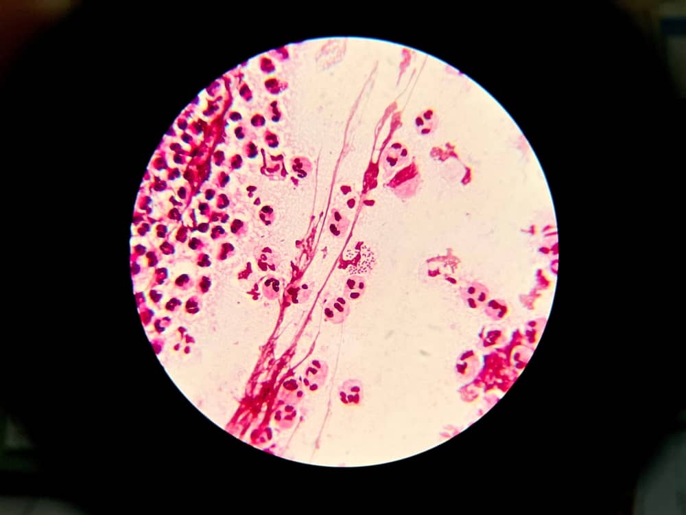 hướng dẫn chi tiết đọc kết quả nhuộm soi