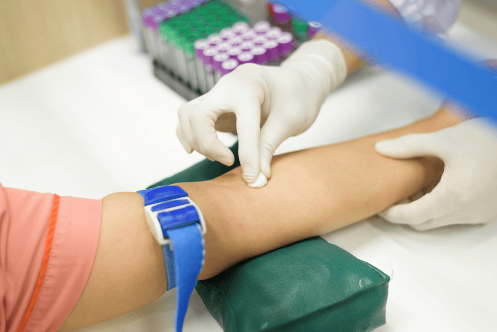 lấy máu bằng ống chân không là gì