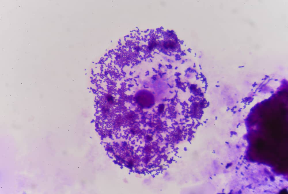 nhuộm gram tránh nhiễm khuẩn