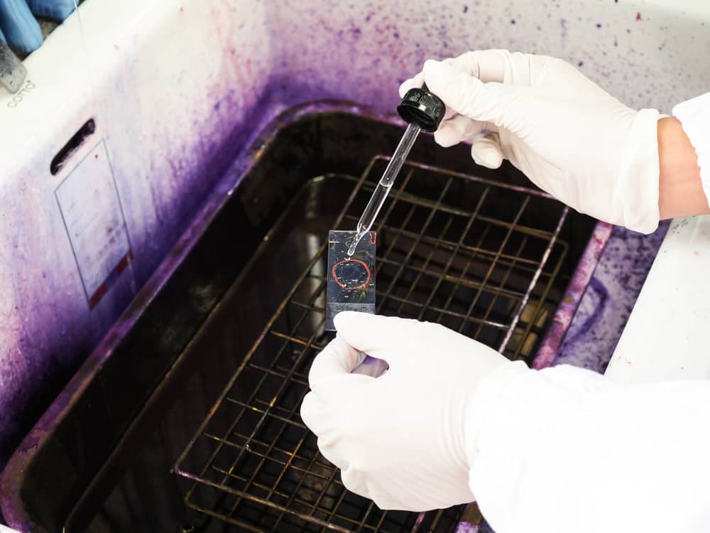 nhuộm gram truyền thống