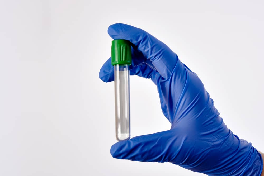 Ống lấy mẫu Citrate nắp xanh