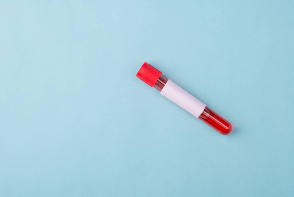 Ống lấy mẫu serum nắp đỏ
