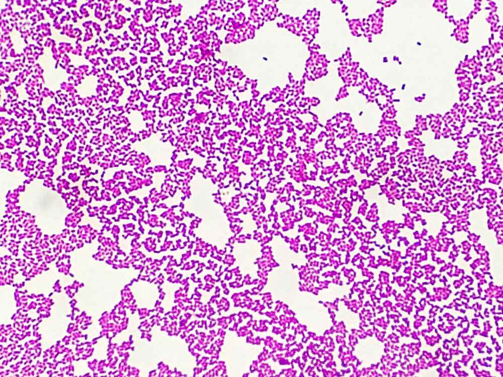 Phương pháp nhuộm gram trực khuẩn gram âm