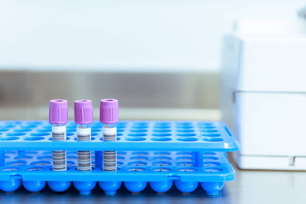 quy trình thực hiện lấy máu bằng ống chân không