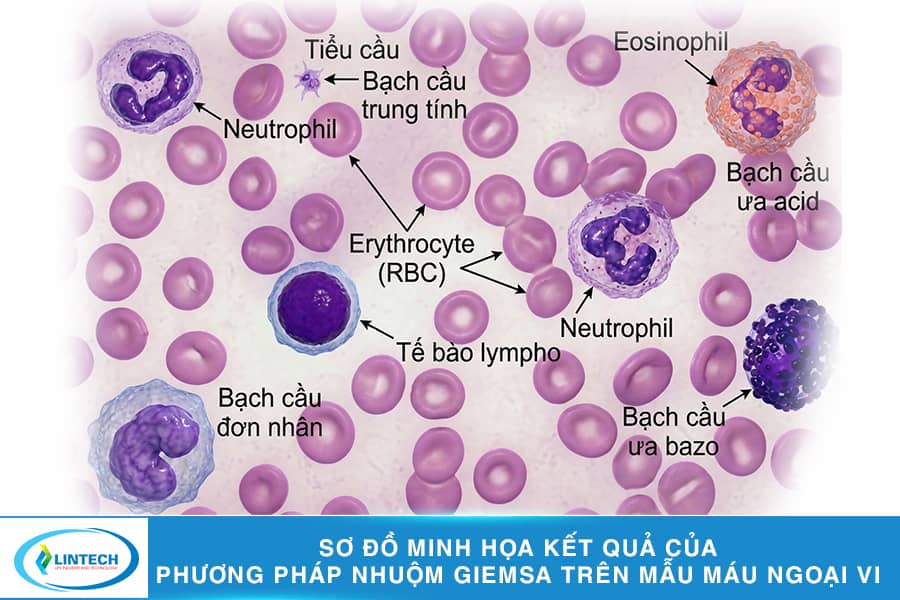 Sơ đồ minh họa nhuộm Giemsa