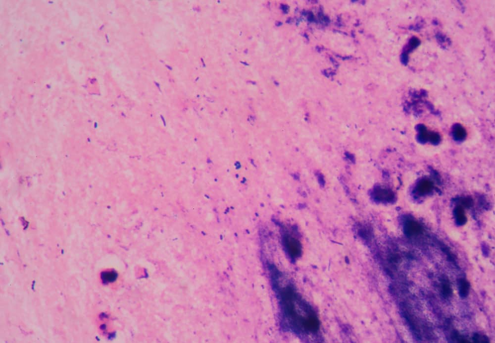 tạp khuẩn tỏng nhuộm gram là gì