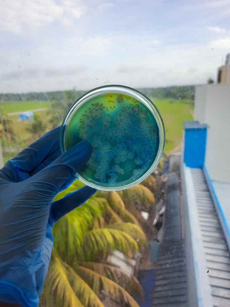 trực khuẩn gram âm ý nghĩa nhuộm gram