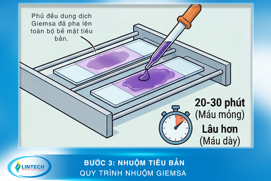 Bước 3 nhuộm tiêu bản trong quy trình nhuộm Giemsa
