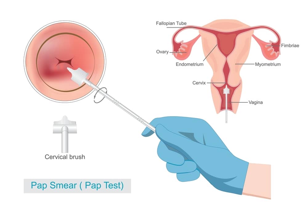 Các phương pháp tầm soát ung thư hiện nay