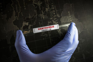 hantavirus symptoms