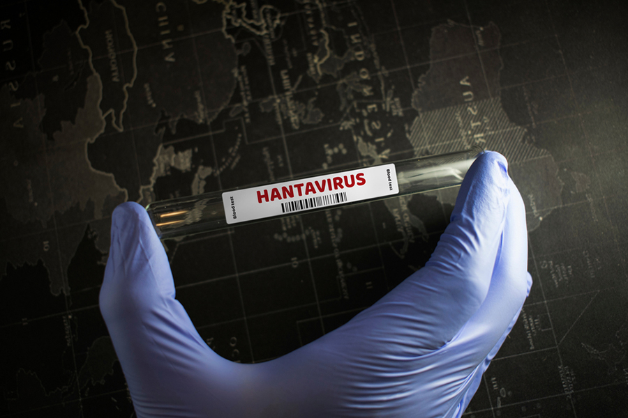 hantavirus symptoms