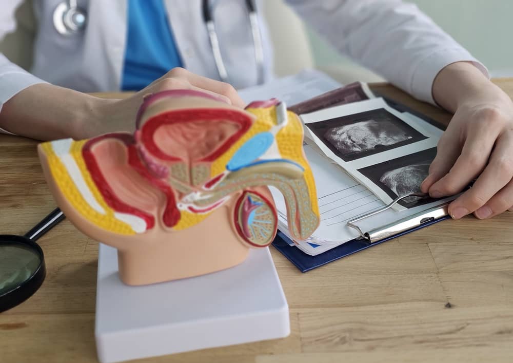 Khuyến nghị quan trọng xét nghiệm HPV ở nam giới