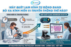 Kính hiển vi so với máy quét lam kính tự động
