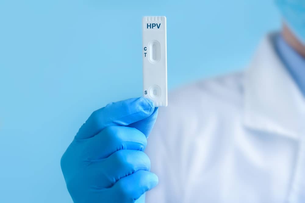 nếu xét nghiệm âm tính HPV có cần xét nghiệm lại không?