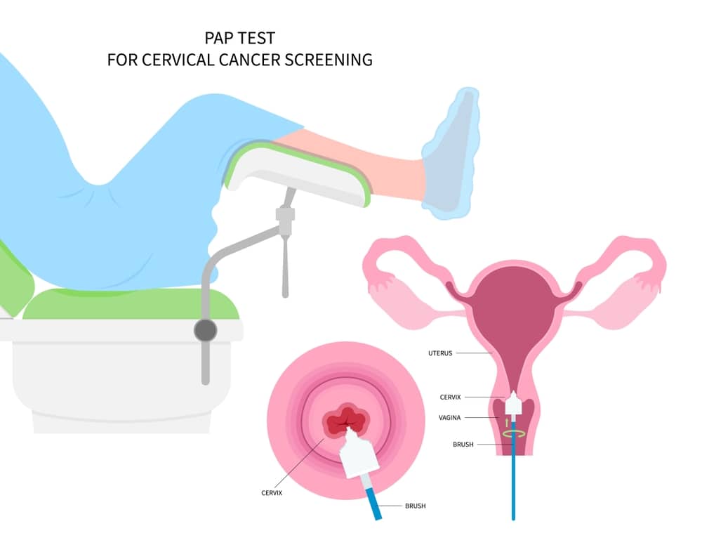 Quy trình thực hiện test HPV tại nhà