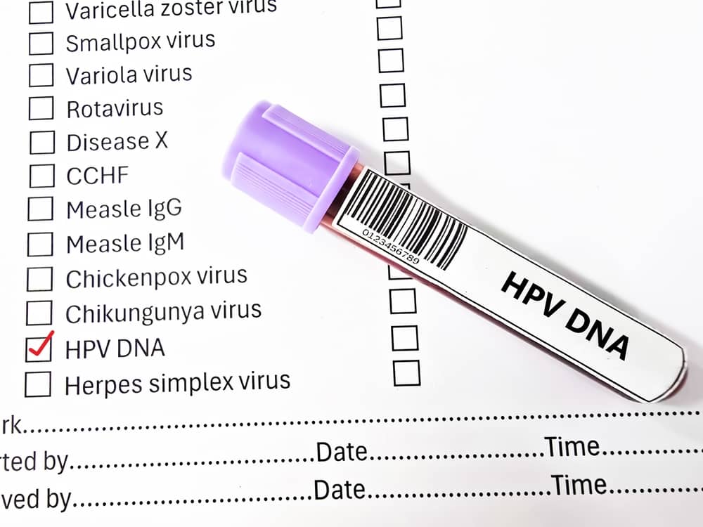 Xét nghiệm HPV DNA như thế nào