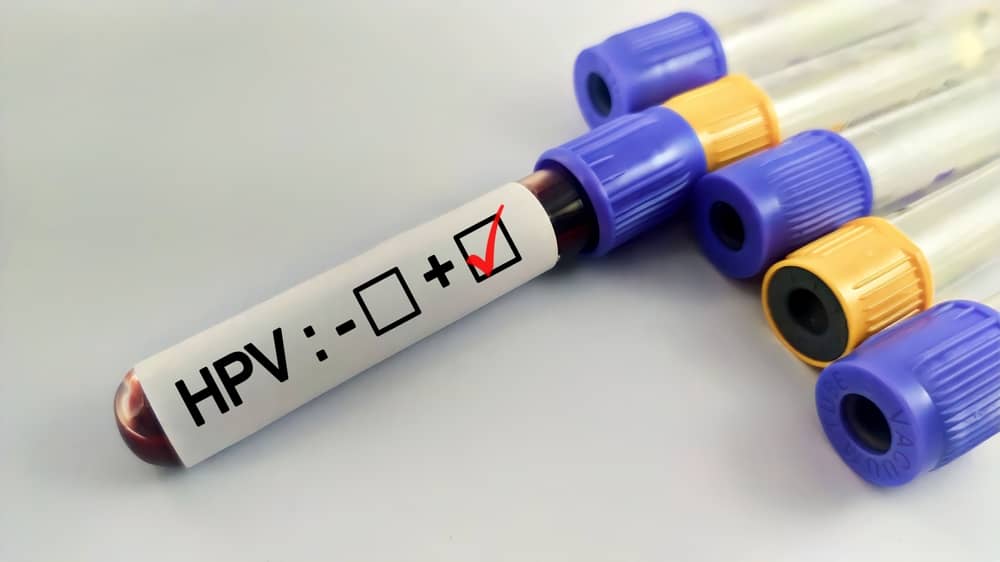 Xét nghiệm HPV dương tính có nguy hiểm không