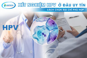 xét nghiệm hpv ở đâu