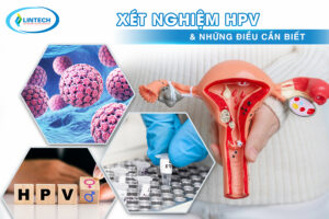 Xét nghiệm HPV