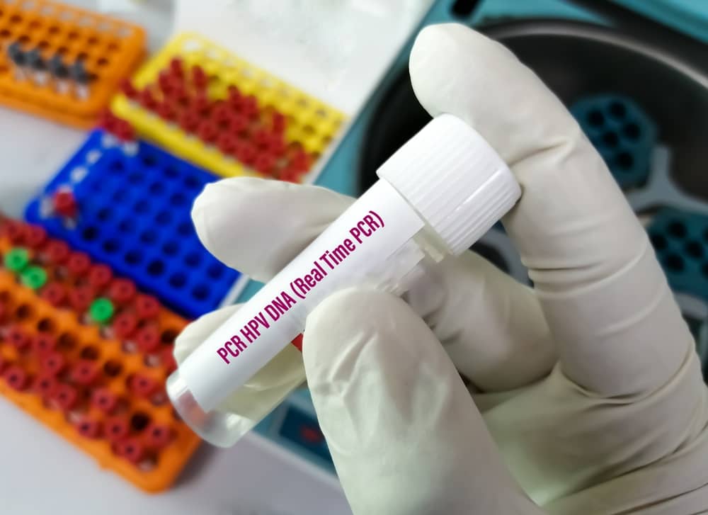 xét nghiệm hpv với kỹ thuật real time pcr