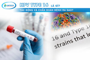 HPV Type 16