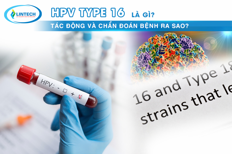 HPV Type 16