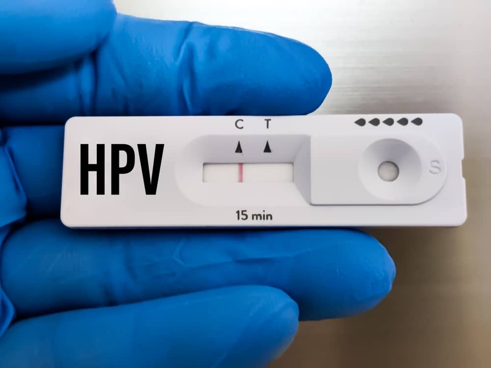 Nguyên lý hoạt động của test nhanh HPV