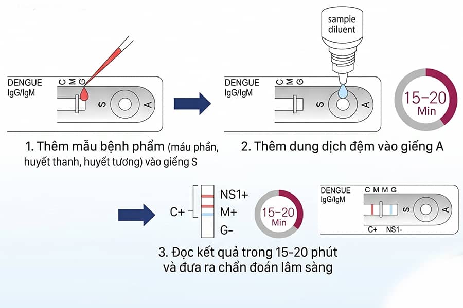 Test nhanh dengue Fever Antibody IGG