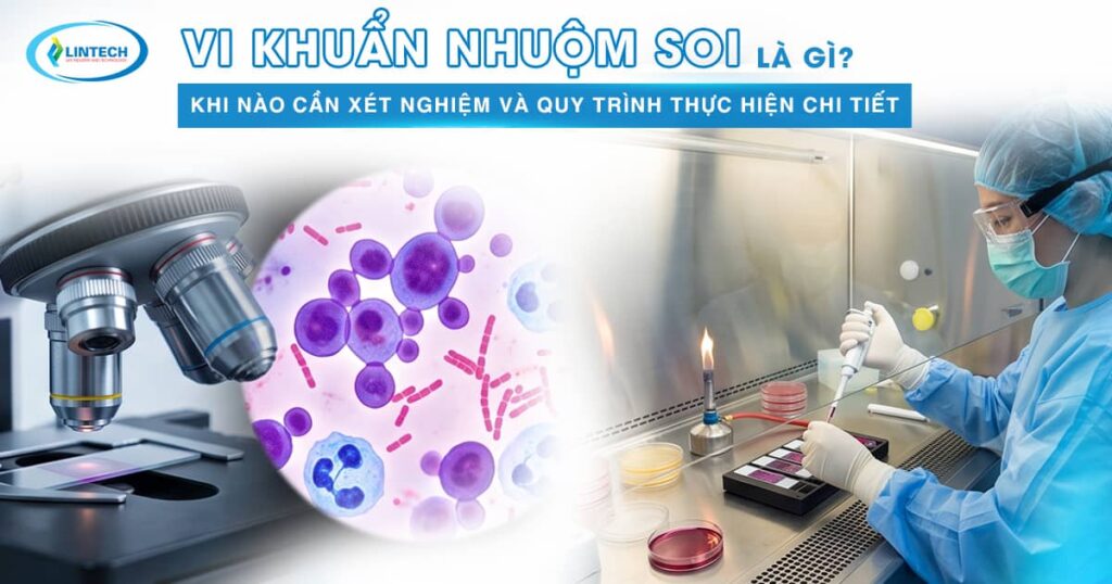 vi khuẩn nhuộm soi